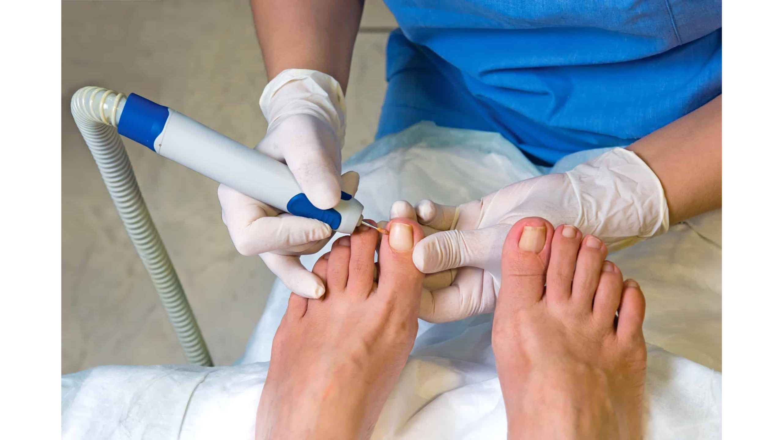 Is a Podiatrist Covered by Insurance